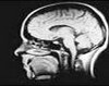 Limitele neurostiintelor in explicarea mintii si constiintei umane
