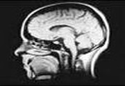 Limitele neurostiintelor in explicarea mintii si constiintei umane